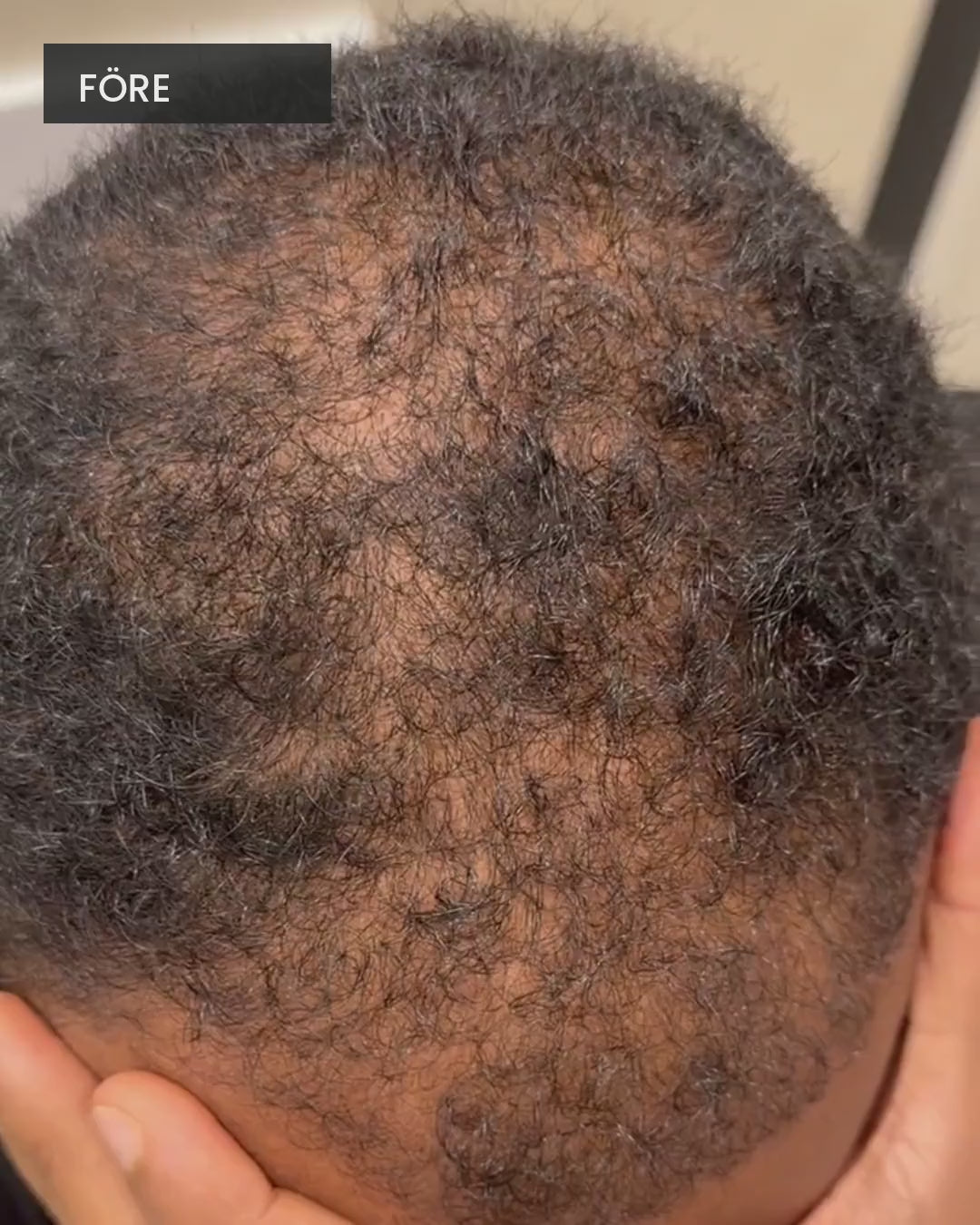 Fyldigt Hårfibrer – före, applicering och efter på 14 sekunder